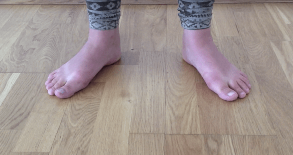 Feet turning outwards