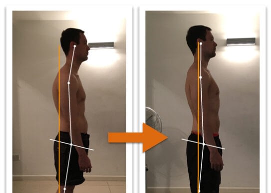 Before and after photos showing amazing improvement of a man's posture from side view after Egoscue Method