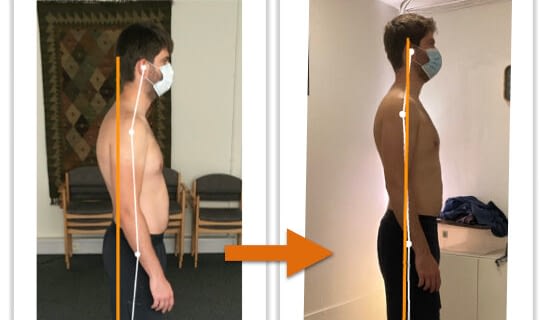 Before and after photos showing improvement of a man's body alignment from side view after posture correction therapy