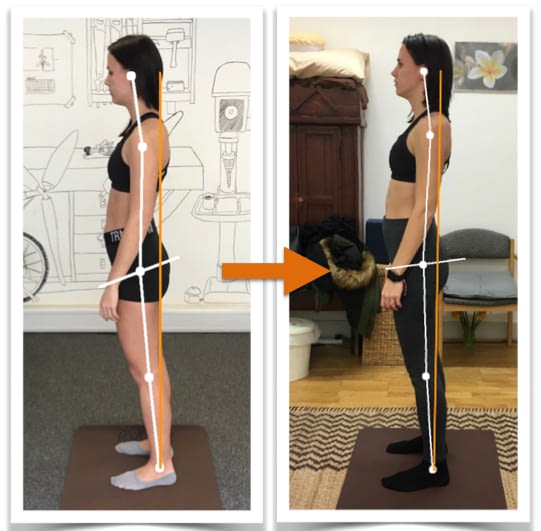 Before and after photos showing good improvement of a woman's body alignment from side view after posture correction therapy