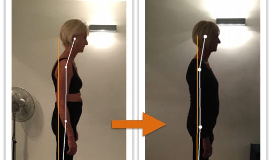 Before and after photos showing improvement of a woman's posture from side view after Egoscue Method