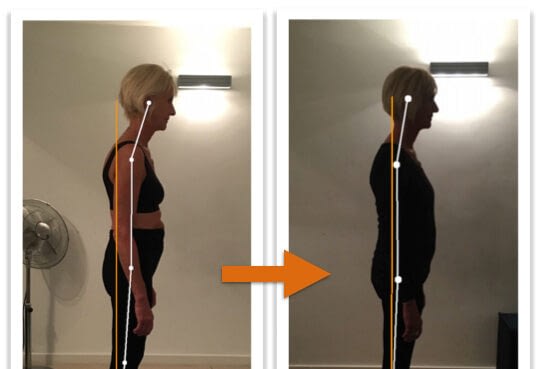 Before and after photos showing improvement of a woman's posture from side view after Egoscue Method