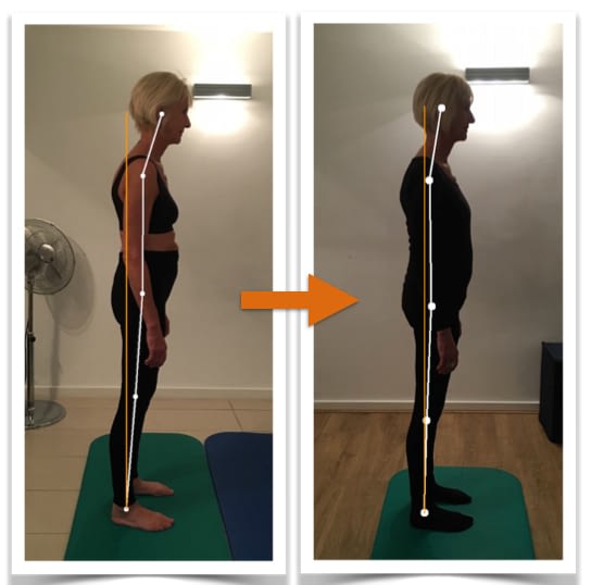 Posture Correction example of client L