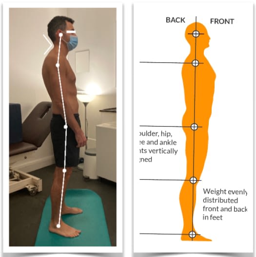 Photo of a man's poor posture from side view compared with an image of ideal posture