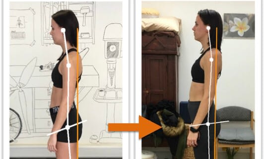 Before and after photos showing improvement of a woman's body alignment from side view after posture correction therapy