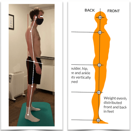 Photo of a man's poor posture from side view compared with an image of correct posture