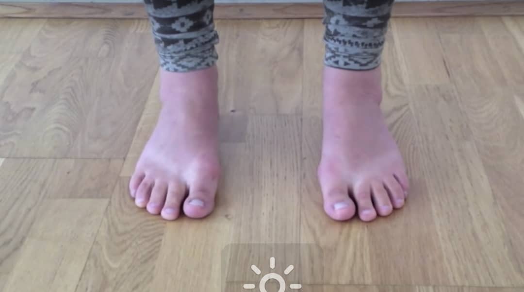 Barefoot feet pointing straight ahead