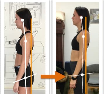 Before and after photos showing improvement of a woman's body alignment from side view after posture correction therapy