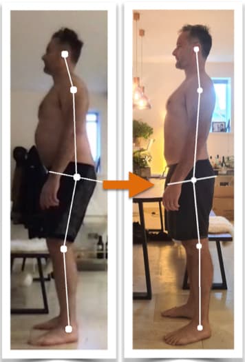 Before and after photos showing remarkable improvement of a man's body alignment from side view after posture correction therapy