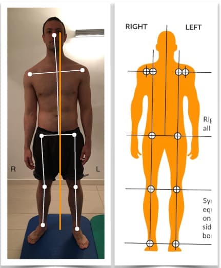 Photo of a man's poor posture from front view compared with an image of correct posture