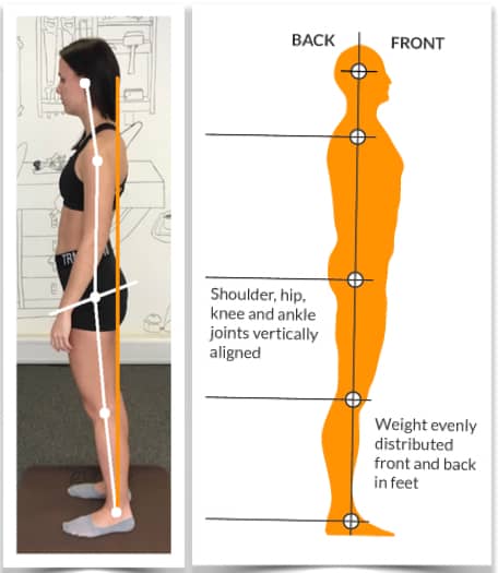 Photo of a woman's poor posture from side view compared with an image of correct posture